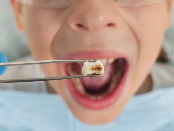 Best Weekend Emergency Dental Services in Exeter, CA